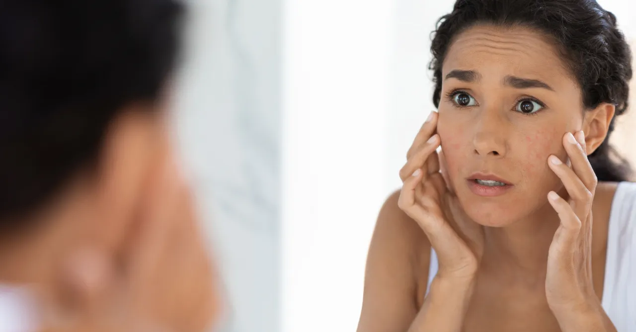 Worried woman examining irritated skin in the mirror.