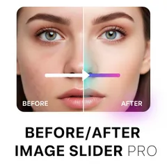 Before/After Image Slider Pro