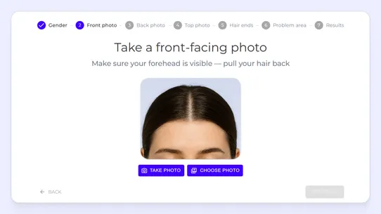 iHairium – AI Hair Analysis screenshot