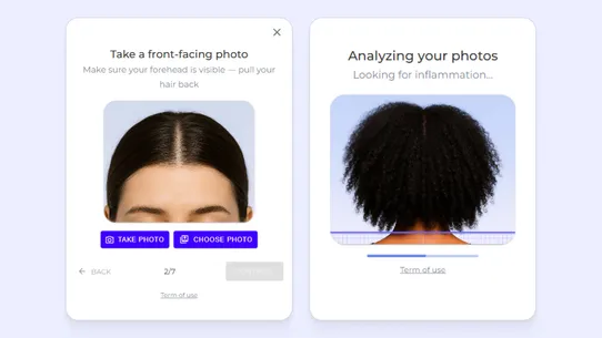 iHairium – AI Hair Analysis screenshot